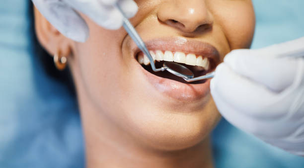 Best Emergency Dentist for Knocked-Out Tooth in East Whittier, CA